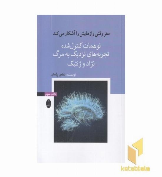 مغزوقتی رازهایش راآشکار-سوم-توهمات