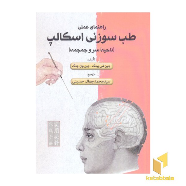 راهنمای عملی طب سوزنی اسکالپ