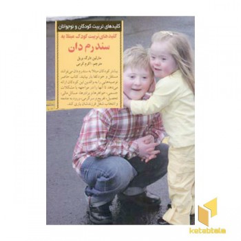 کلیدهای تربیت(کودک مبتلا به سندرم دان)