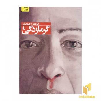 گرمازدگی